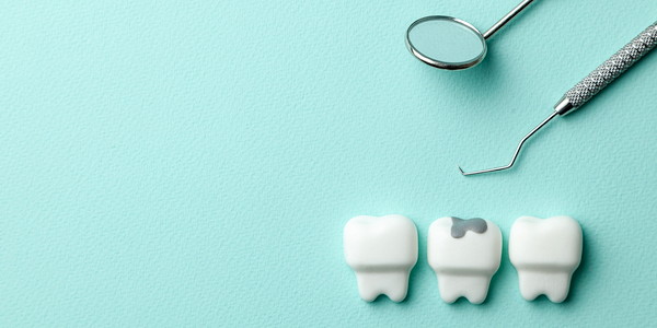 虫歯を治療する歯医者のイメージ画像