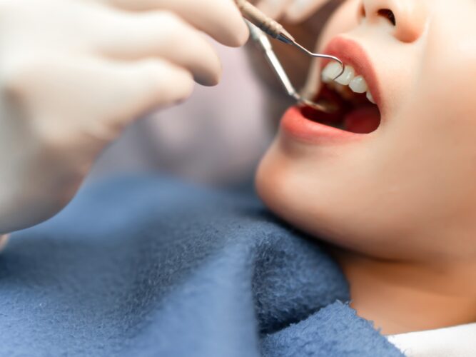 一般歯科/歯周病治療イメージ